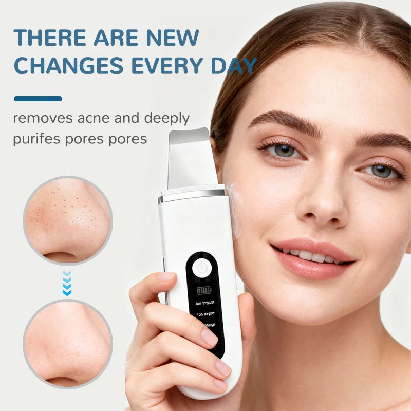 Electric Blackhead Remover